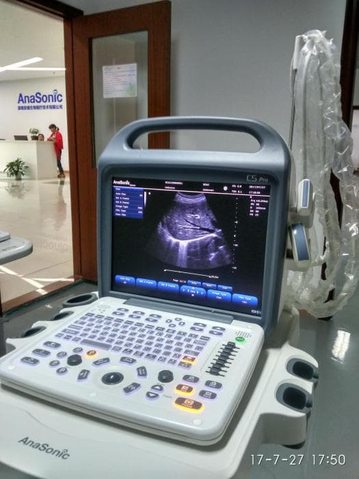 Portable ultrasound system with display and control panel